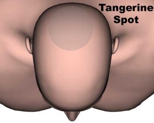 your tangerine spot